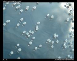 appearance of s.epidermidis colonies on agar